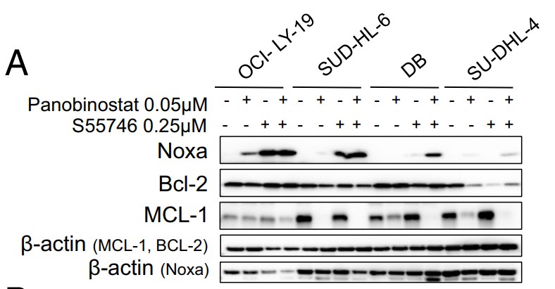 Western blot showing increase in NOXA protein levels and decrease in MCL1.jpg
